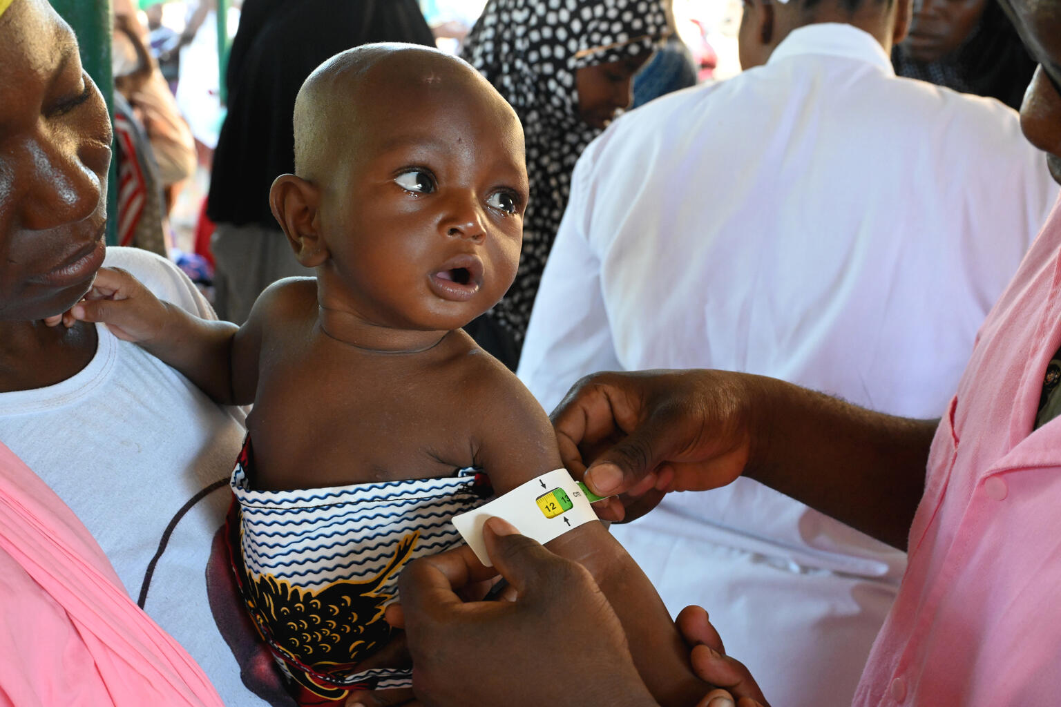 Health workers measure the circumference of a child's arm